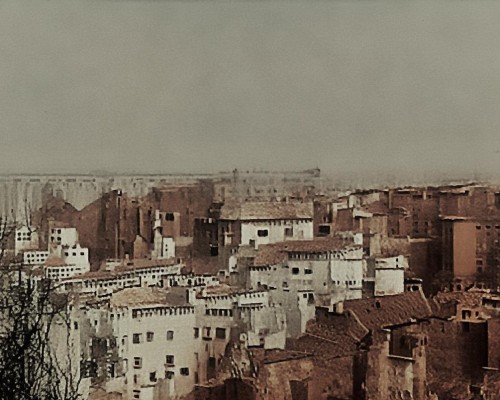 好，我现在需要帮用户写一篇关于鼻头肥大缩小的文章。用户是上海的鼻整形医生，所以文章需要专业且详细。首先，我得确定文章的结构，通常包括标题、引言、鼻头肥大的原因、手术方法、恢复过程、注意事项以及结论