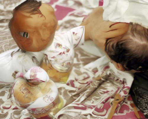 好，我现在需要帮用户写一篇关于疤痕增生的文章。用户是上海的鼻整形医生，所以文章应该专业且有实用价值。首先，我得理解疤痕增生的原因和影响，这样才能全面地分析这个问题