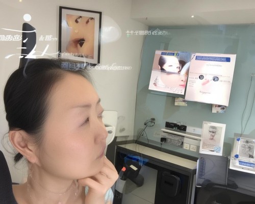 好，我现在需要帮用户写一篇关于鼻头肥大缩小的文章。用户是上海的鼻整形医生，所以文章需要专业且详细。首先，我得确定文章的结构，可能包括鼻头肥大的原因、手术方法、恢复过程以及注意事项