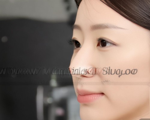 上海鼻整形医生推荐，鼻尖成形术全解析