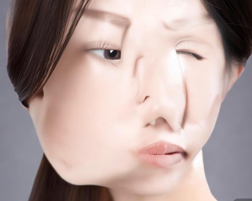 鼻修复手术，专业医生的选择与手术方案解析