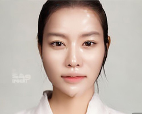 网红鼻整形，美丽背后的隐患与专业建议