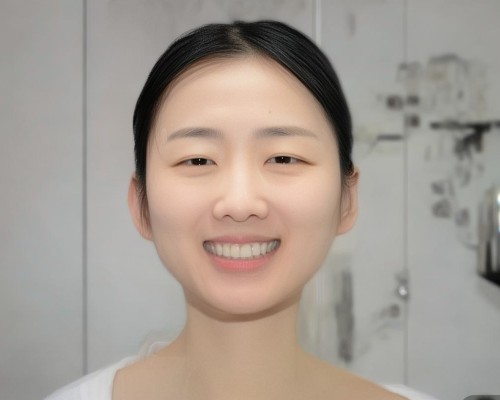 重塑精致东方鼻梁，膨体鼻综合优势解析，上海鼻整形医生深度解读
